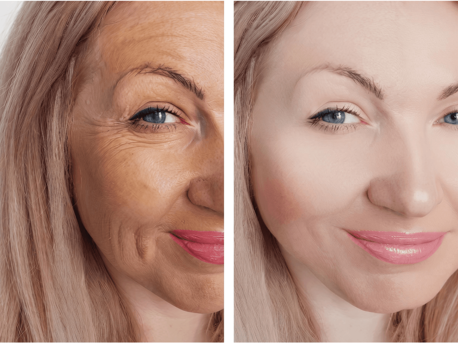 Facial Rejuvenation
