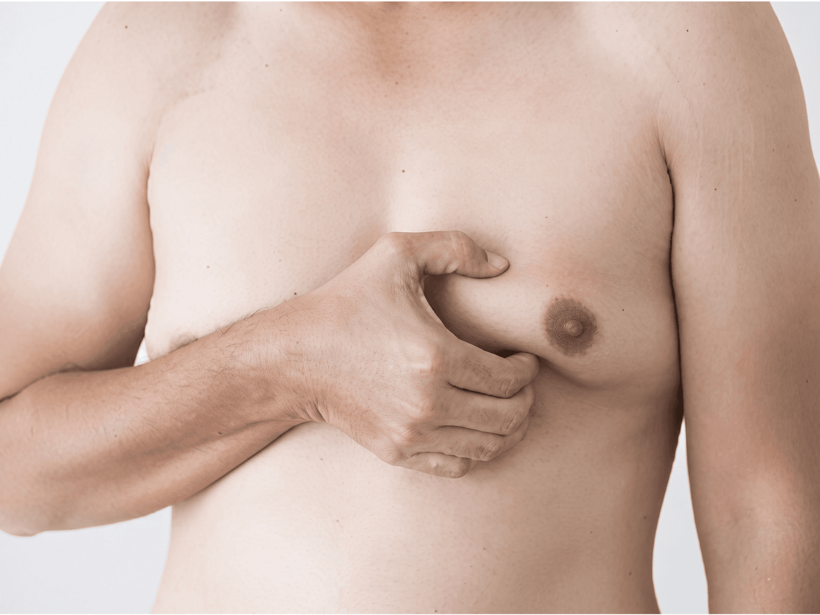 Gynecomastia Surgery (Male Chest Reduction)